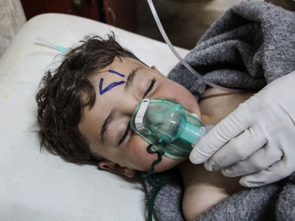 PHOTO: A Syrian child receives treatment after an alleged chemical attack at a field hospital in Saraqib, Idlib province, Syria, April 4, 2017.