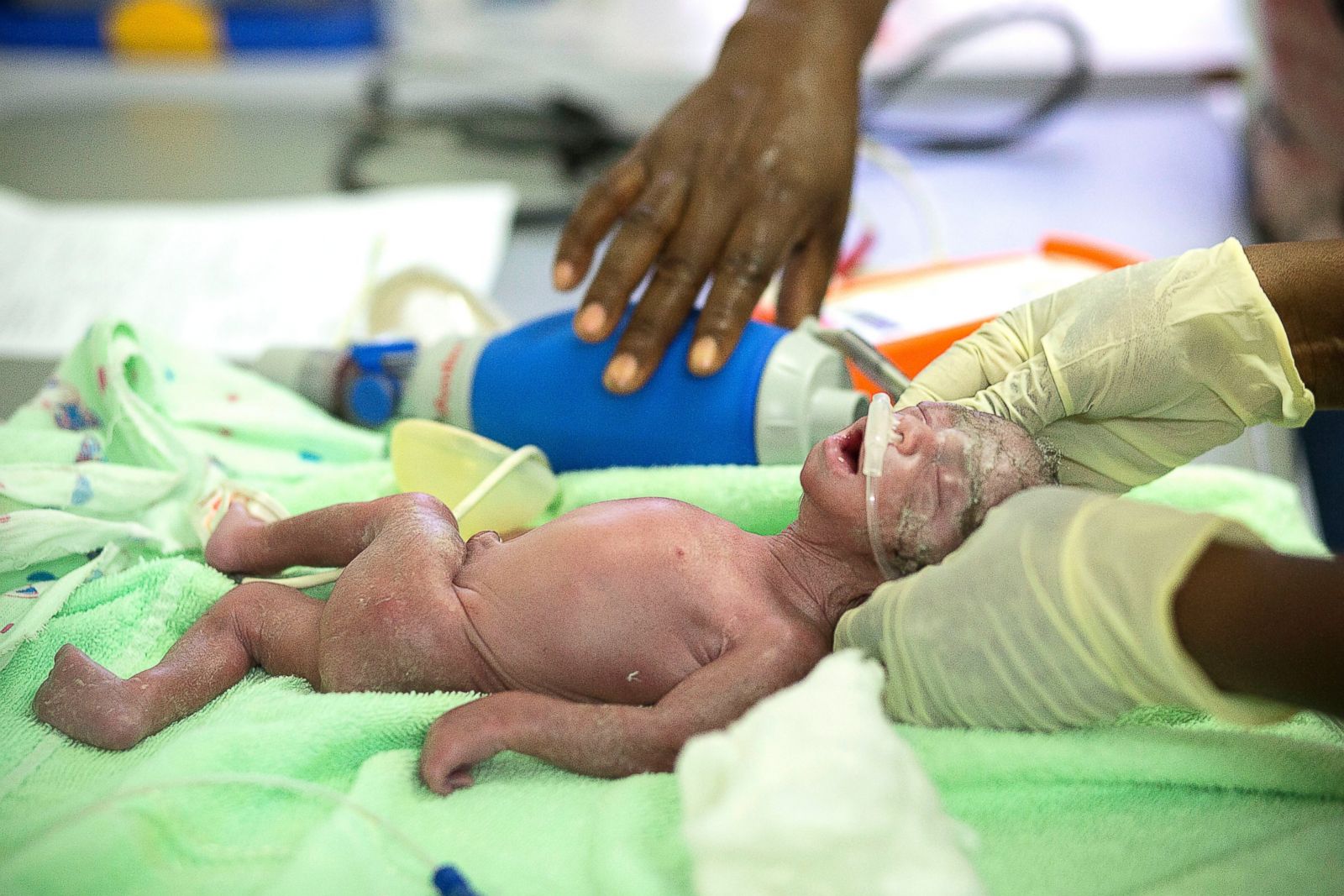 Haiti's Precarious State of Health Care for Pregnant Women ...