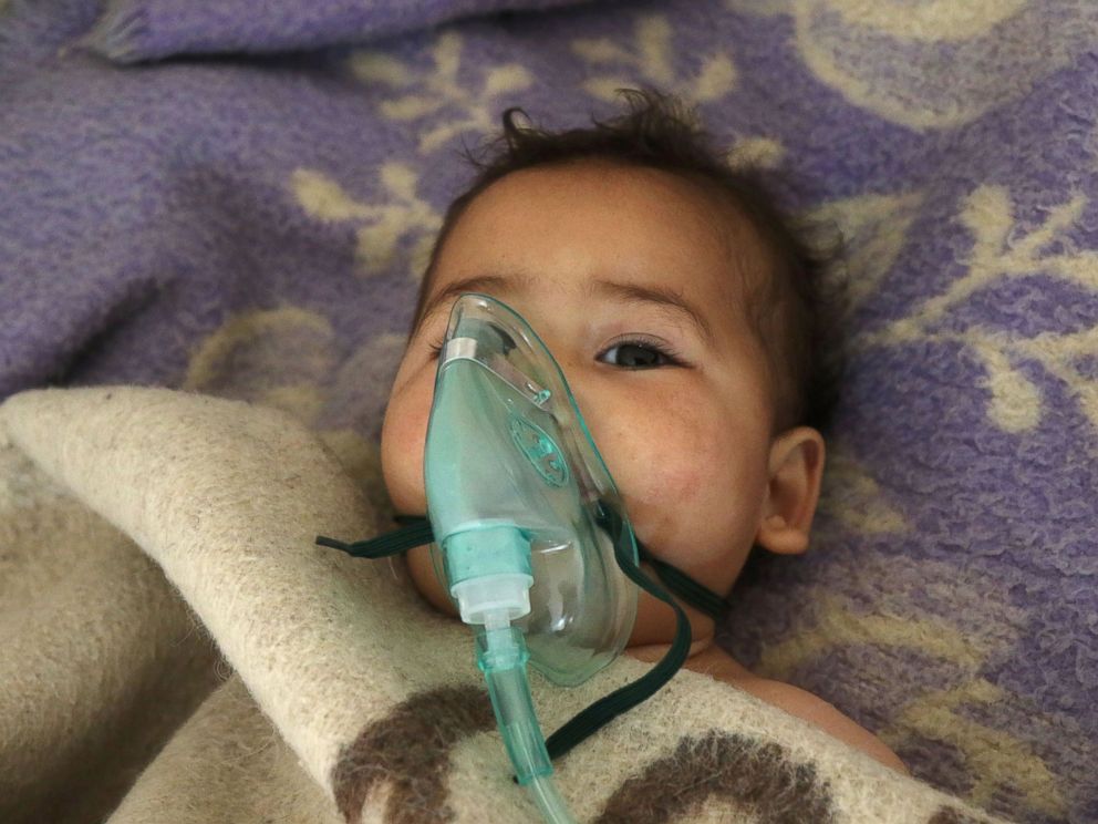 PHOTO: A Syrian child receives treatment following a suspected toxic gas attack in Khan Sheikhun, a rebel-held town in the northwestern Syrian Idlib province, on April 4, 2017.
