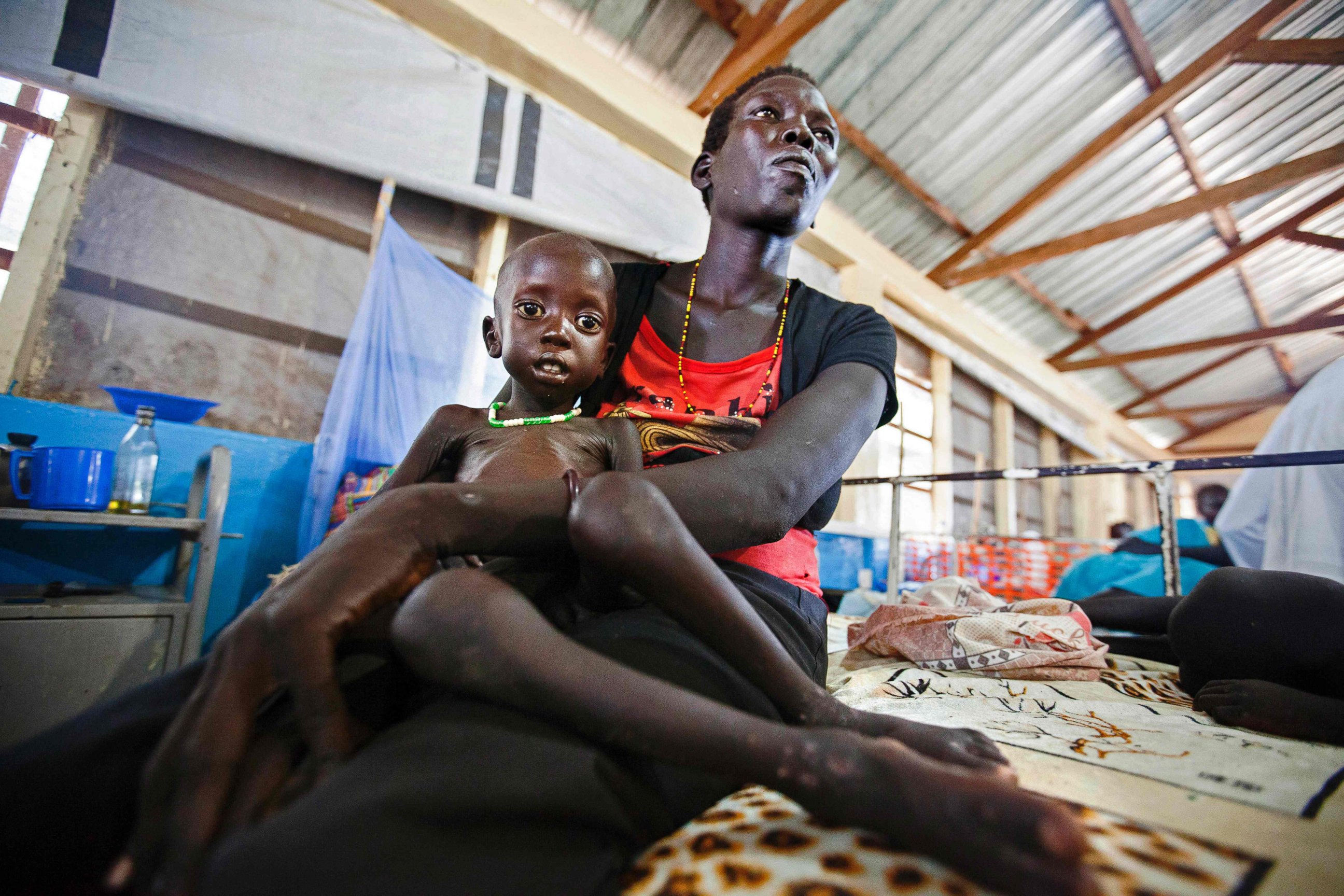 PHOTO: Lucia Adeng Wek holds her son Wek Wol Wek, 3, who suffers acute malnutrition at the clinic run by Doctors without Borders (MSF) in Aweil, Northern Bahr al Ghazal, South Sudan, Oct. 11, 2016.