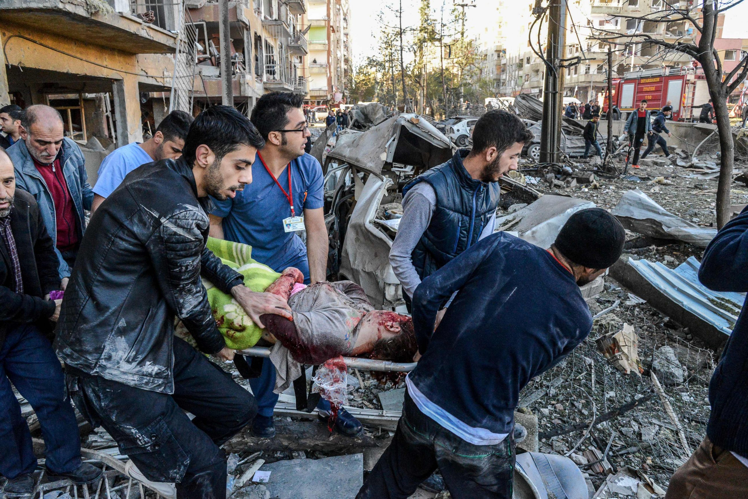 PHOTO: Rescue officials and people carry an injured man at the explosion site, Nov. 4, 2016, after a strong blast in the southeastern Turkish city of Diyarbakir.