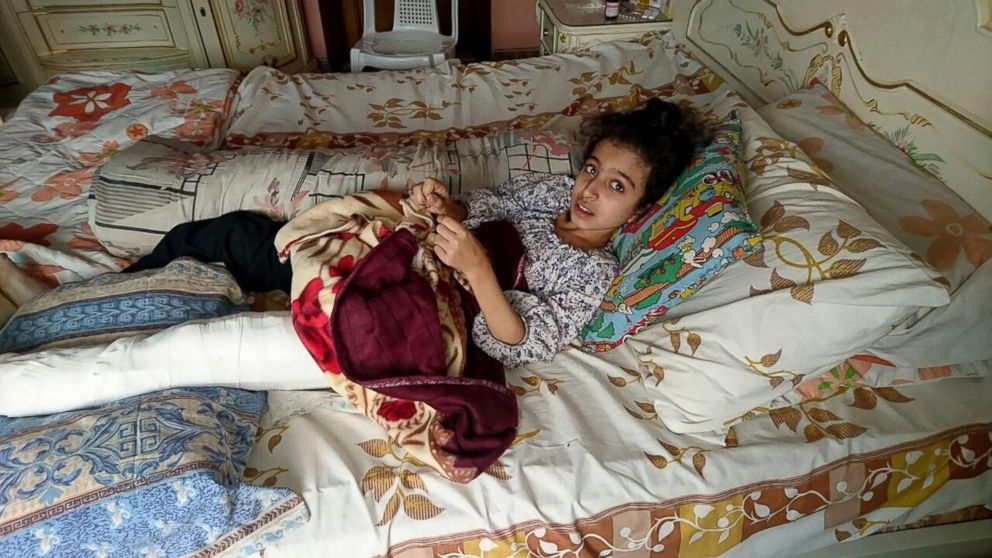 PHOTO: A handout picture taken by a family member and released by human rights organization Amnesty International on August 13, 2016 shows Syrian girl Ghina Ahmad Wadi resting at her home in the Syrian city of Madaya.
