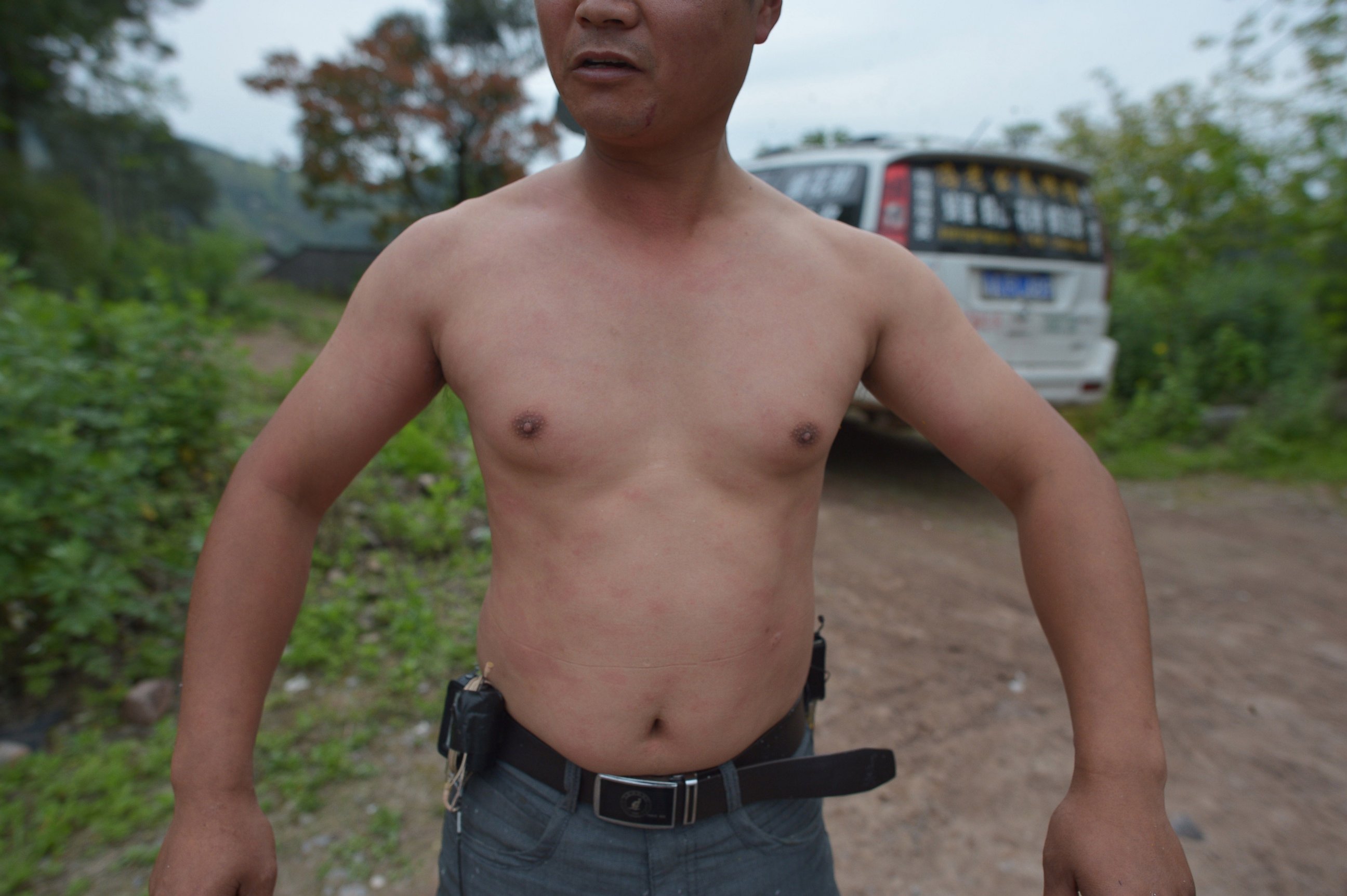 PHOTO: This picture taken on April 9, 2014 shows She Ping, a 34 year-old local beekeeper, showing his body after wearing bees on a small hill in southwest China's Chongqing. 