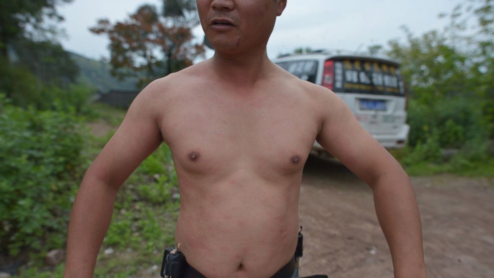 PHOTO: This picture taken on April 9, 2014 shows She Ping, a 34 year-old local beekeeper, showing his body after wearing bees on a small hill in southwest China's Chongqing. 