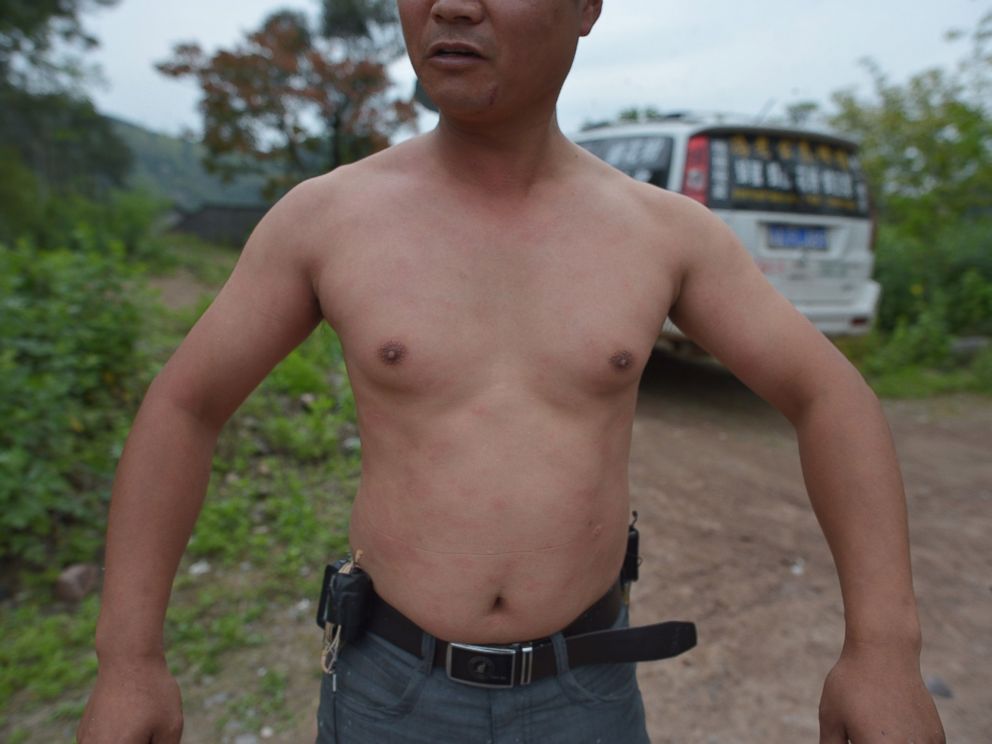 PHOTO: This picture taken on April 9, 2014 shows She Ping, a 34 year-old local beekeeper, showing his body after wearing bees on a small hill in southwest Chinas Chongqing.