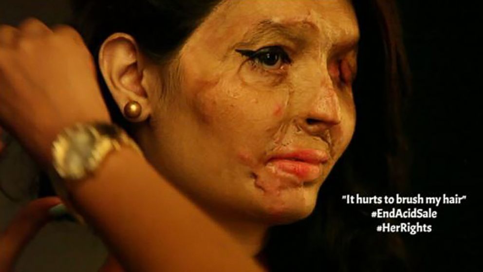 PHOTO:Reshma Qureshi, who was the victim of acid attack, will be walking the runway during New York Fashion Week. This image taken from the Make Love Not Scars Instagram site. 
