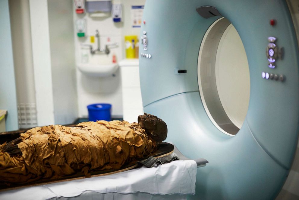 PHOTO: The mummified body of the ancient Egyptian priest Nesyamun undergoes a CT scan at Leeds General Infirmary in Leeds, England, in September 2016.