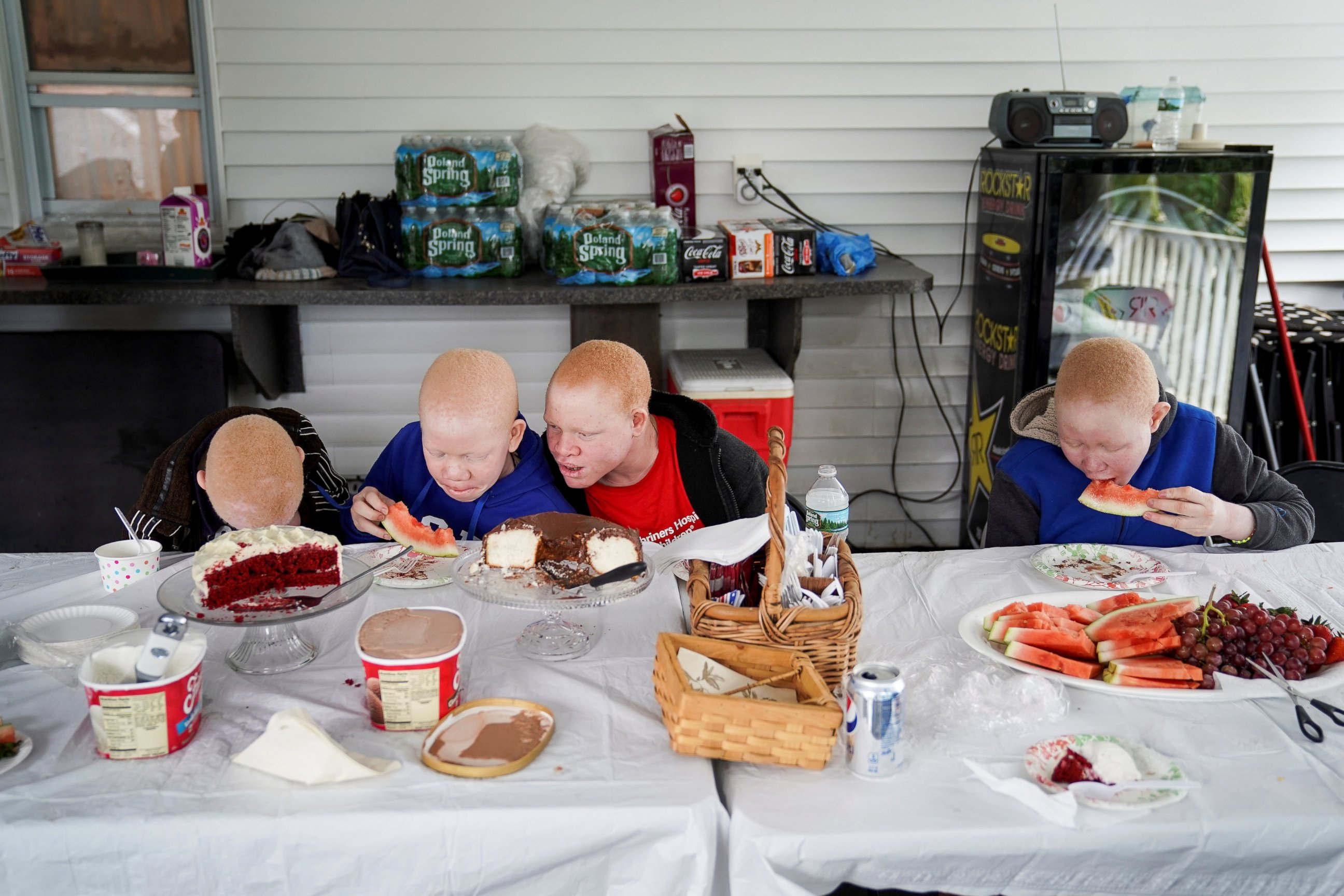 Baraka Lusambo, 7, Mwigulu Magesaa 14, Emmanuel Rutema, 15, and Pendo Noni 16, Tanzanians with albinism who had body parts chopped off in witchcraft-driven attacks, eat dinner at a home in the Staten Island borough of New York, June 4, 2017. 