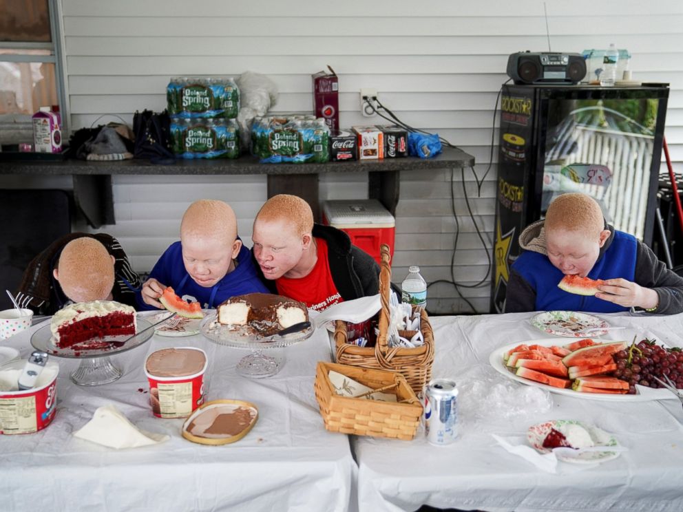 Baraka Lusambo, 7, Mwigulu Magesaa 14, Emmanuel Rutema, 15, and Pendo Noni 16, Tanzanians with albinism who had body parts chopped off in witchcraft-driven attacks, eat dinner at a home in the Staten Island borough of New York, June 4, 2017.