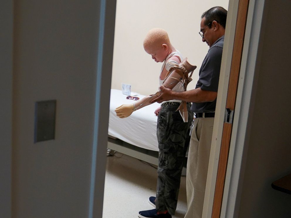 PHOTO: Mwigulu Magesaa 14, a Tanzanian with albinism who had an arm chopped off in a witchcraft-driven attack, gets help in an examination room during a prosthetic fitting at the Shriners Hospital in Philadelphia, May 30, 2017.
