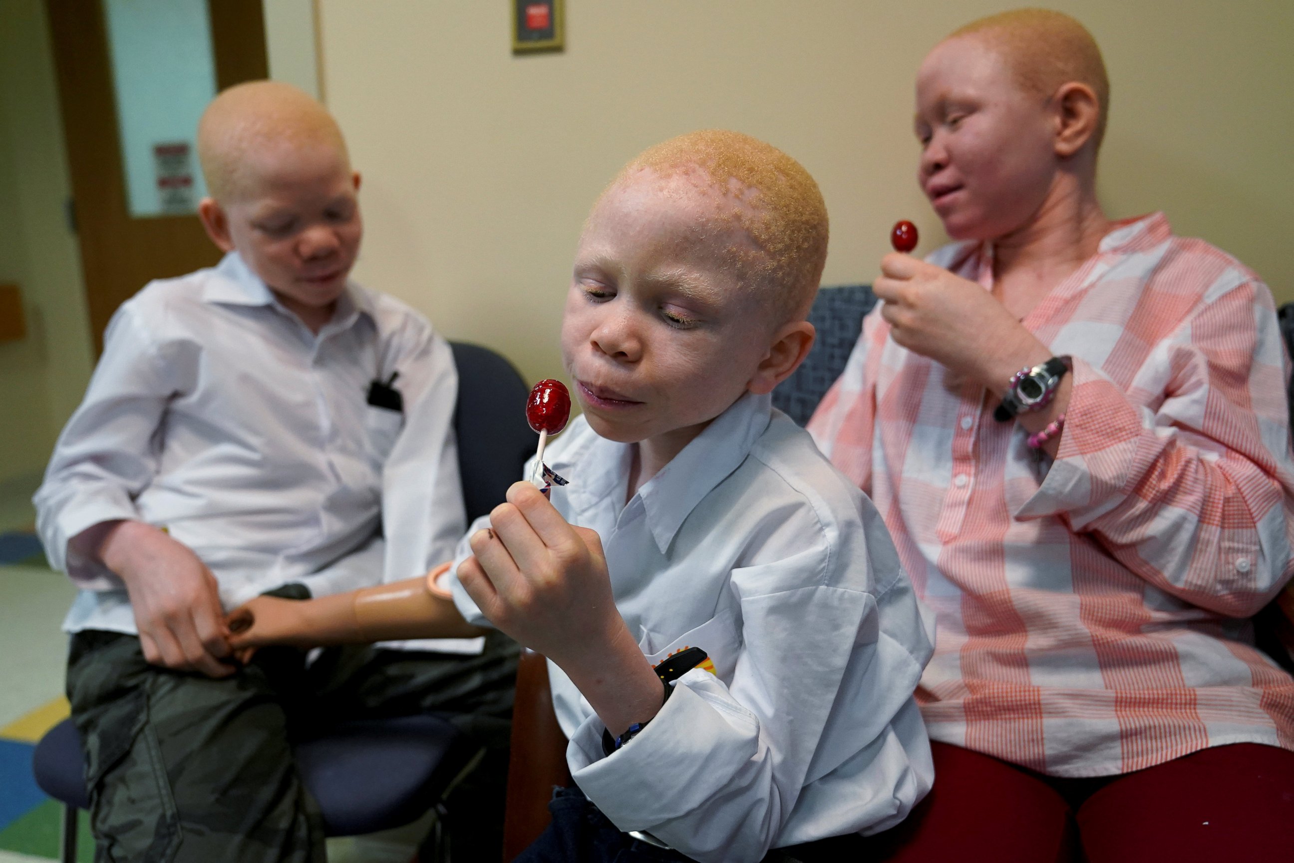 PHOTO: Mwigulu Magesaa, left, Baraka Lusambo, center, and Pendo Noni, wait in the lobby during prosthetic arm fittings at the Shriners Hospital in Philadelphia, May 30, 2017. 