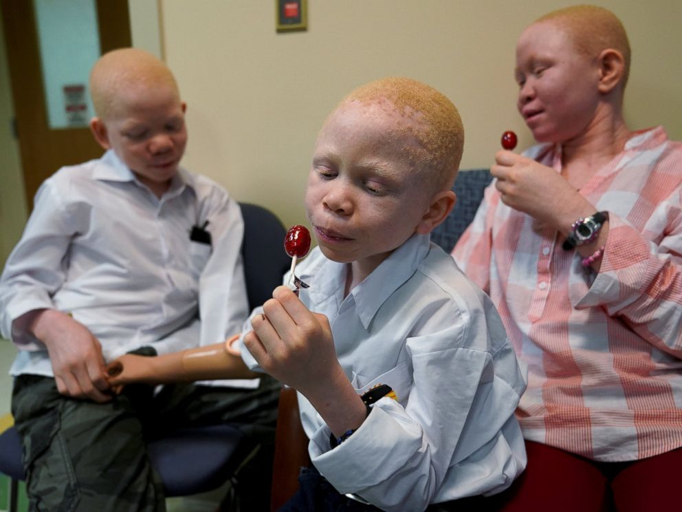 PHOTO: Mwigulu Magesaa, left, Baraka Lusambo, center, and Pendo Noni, wait in the lobby during prosthetic arm fittings at the Shriners Hospital in Philadelphia, May 30, 2017.