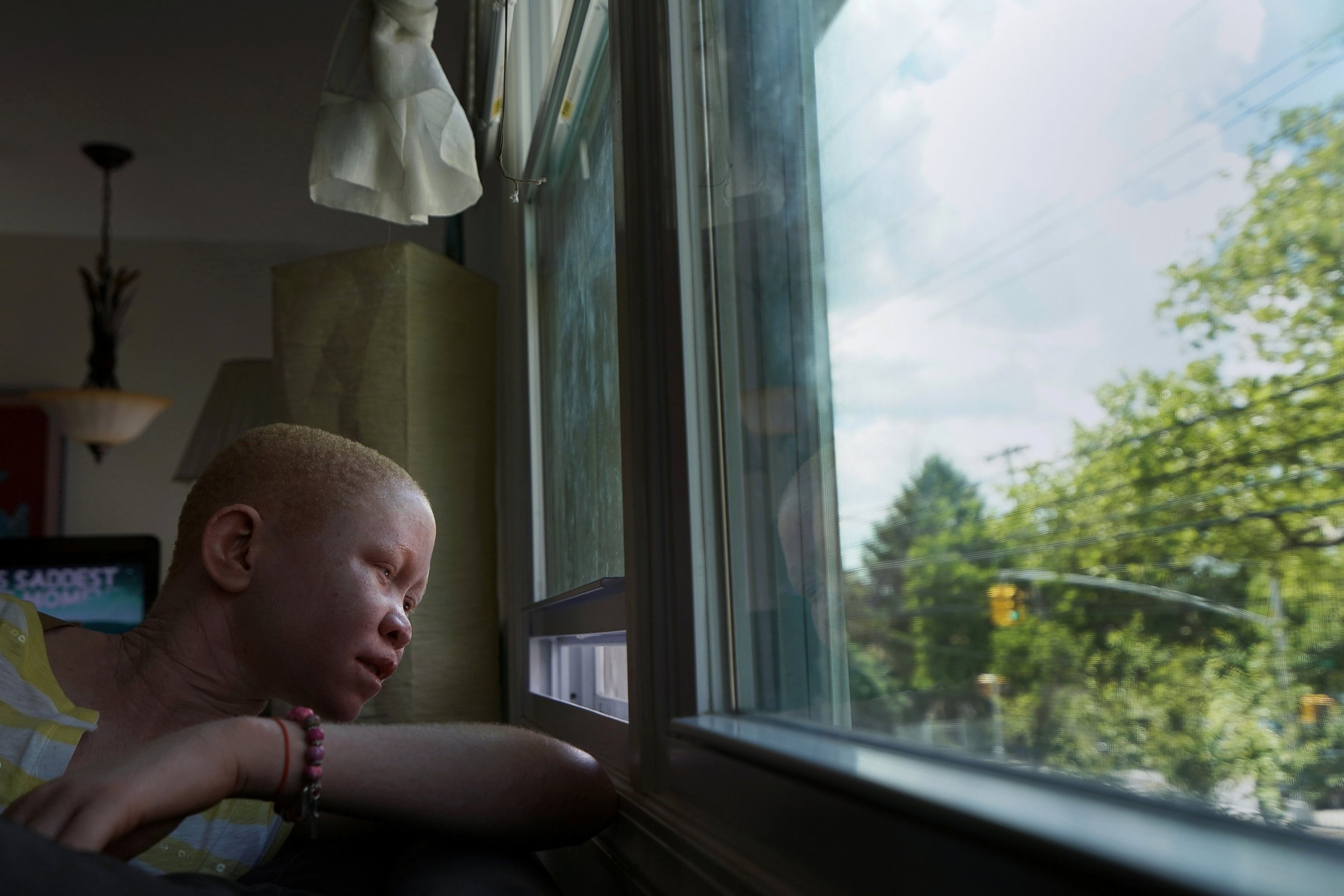 PHOTO: Pendo Noni, 16, a Tanzanian with albinism who had an arm chopped off in a witchcraft-driven attack, looks out of the window at the Global Medical Relief Fund house in the Staten Island borough of New York, June 2, 2017. 