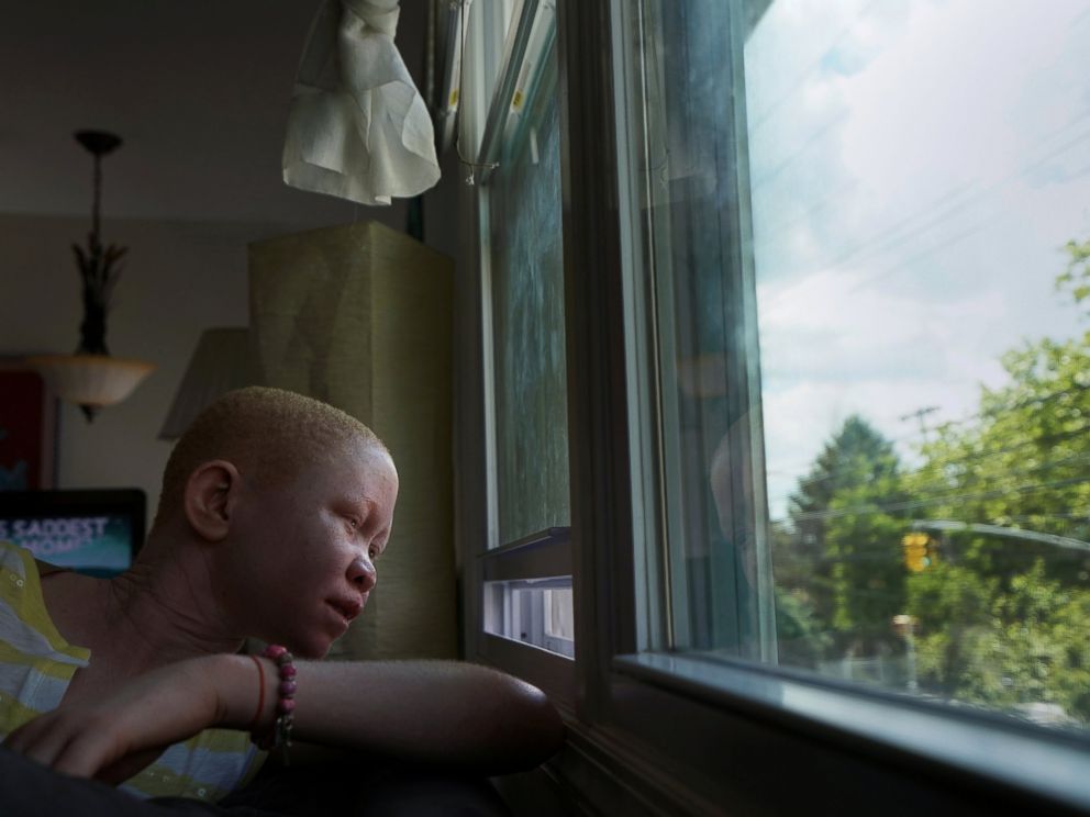 PHOTO: Pendo Noni, 16, a Tanzanian with albinism who had an arm chopped off in a witchcraft-driven attack, looks out of the window at the Global Medical Relief Fund house in the Staten Island borough of New York, June 2, 2017.