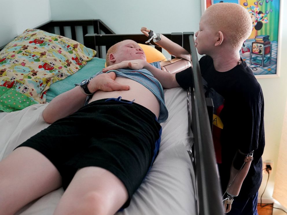 PHOTO: Mwigulu Magesaa 14, wakes up Emmanuel Rutema, 15, both Tanzanians with albinism who had body parts chopped off in witchcraft-driven attacks, at the Global Medical Relief Fund house in the Staten Island borough of New York, June 2, 2017.