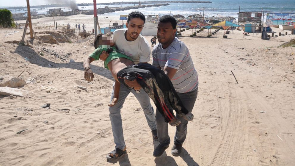 RT_gaza_bombing_child_jtm_140716_16x9_992.jpg