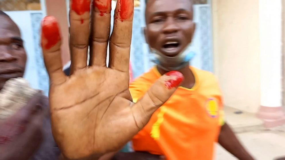 An anti-government demonstrator displays a bloody hand during clashes in N'Djamena, Chad, Thursday Oct. 20, 2022. Chadian security forces have opened fire on anti-government demonstrators in the country's two largest cities killing at least 60 people