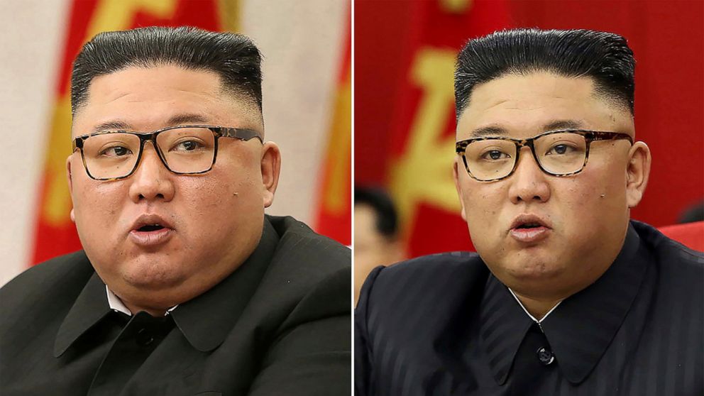 N Korea's Kim looks much thinner, causing health speculation