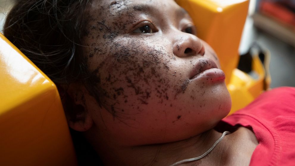 An injured ethnic Karen villager from Myanmar rests as she is treated after crossing the Salawin river via boat at Ban Mae Sam Laep Health Center, Mae Hong Son province, Thailand on Tuesday March 30, 2021. The weekend strikes by the Myanmar military,