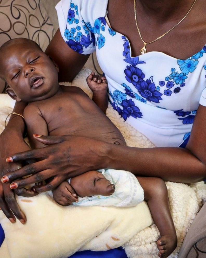South Sudan Ignores Reports On Oil Pollution Birth Defects Abc News
