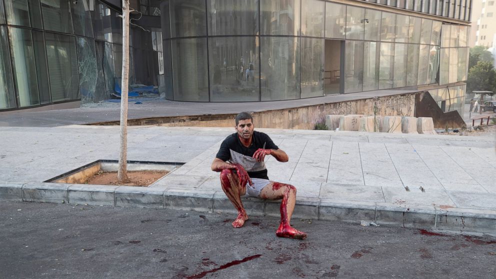 A wounded man sits on a sidewalk after a massive explosion in in Beirut, Lebanon, Tuesday, Aug. 4, 2020. Massive explosions rocked downtown Beirut on Tuesday, flattening much of the port, damaging buildings and blowing out windows and doors as a gian