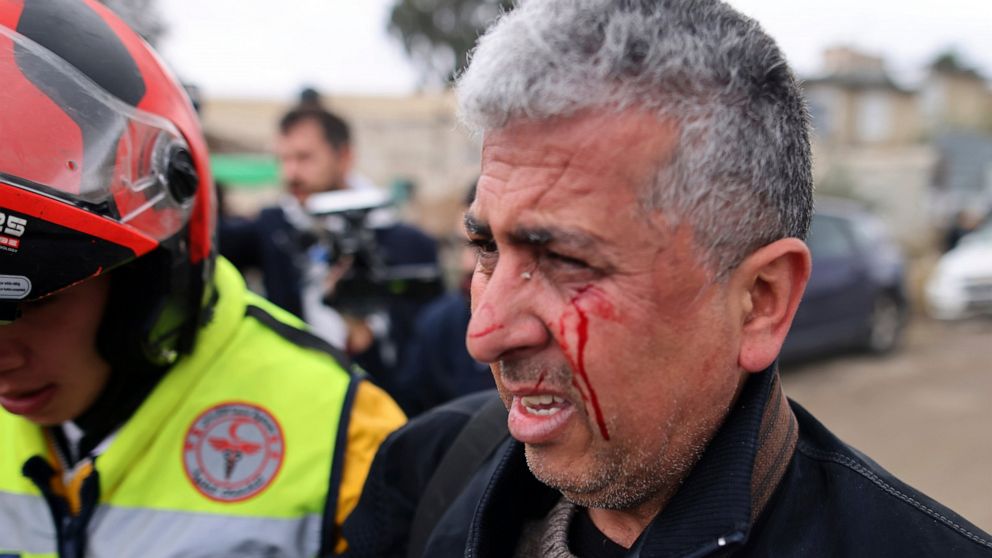 Associated Press photographer Mahmoud Illean reacts after being attacked by Israeli police while covering a demonstration in the east Jerusalem neighborhood of Sheikh Jarrah, Friday, Dec. 17, 2021. Illean had been covering a weekly demonstration wher