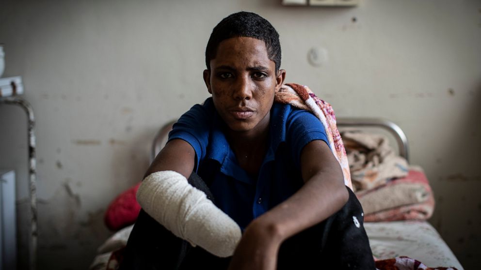 FILE - Haftom Gebretsadik, a 17-year-old from Freweini, Ethiopia, near Hawzen, who had his right hand amputated and lost fingers on his left after an artillery round struck his home in March, sits on his bed at the Ayder Referral Hospital in Mekele, 