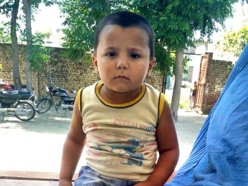PHOTO: Abid Ullah, 3, was diagnosed with polio in 2016 when he was 18 months old.