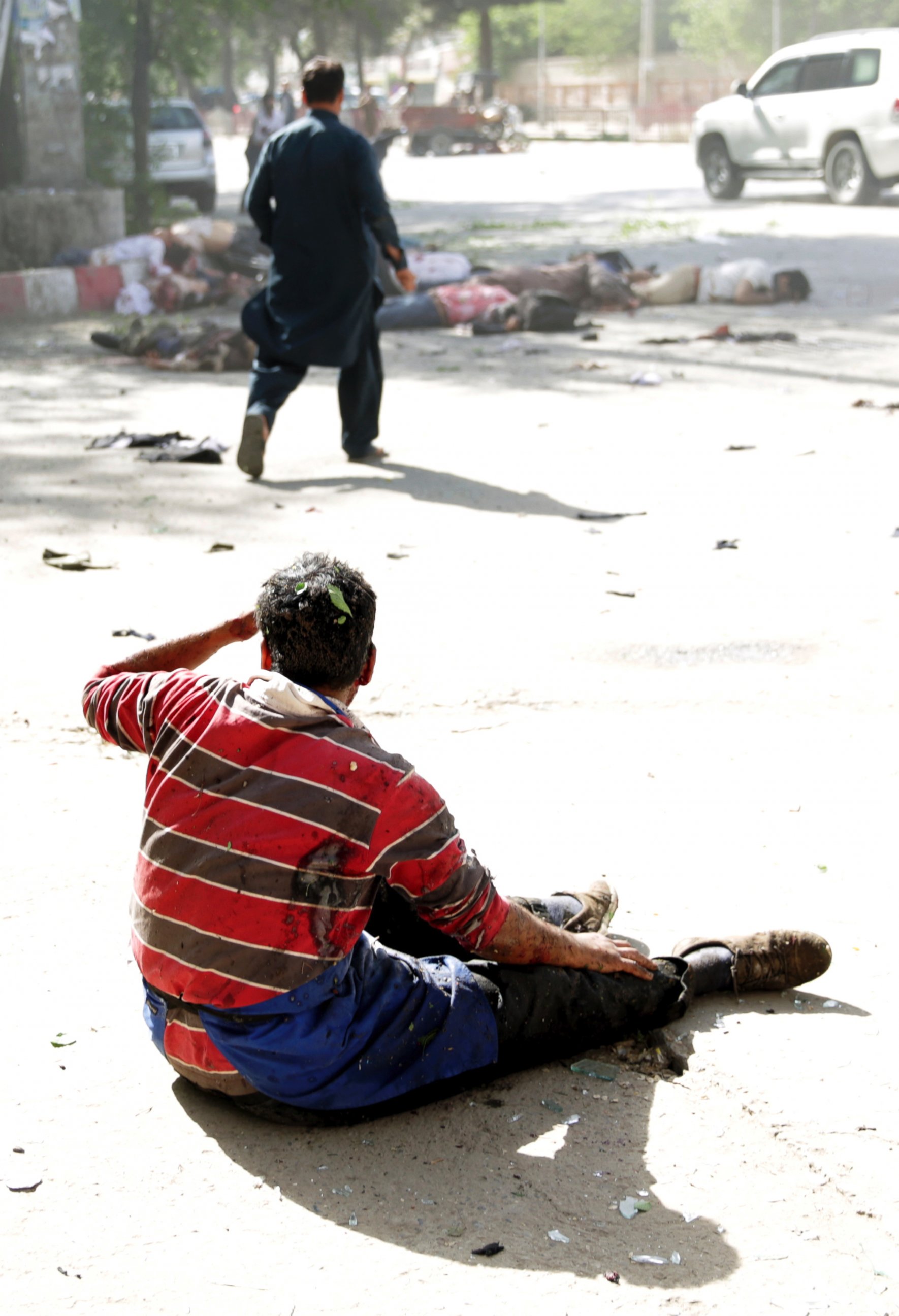 A wounded man looks at the site of double explosions, in Kabul, Afghanistan, Monday, April 30, 2018. The explosions targeted central Kabul on Monday morning, killing people and wounding a dozen, authorities said. 