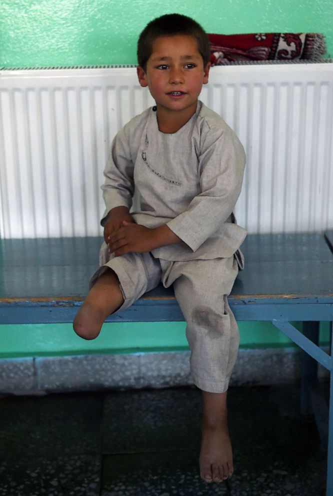 PHOTO: Ahmad Rahman, an Afghan boy who lost his right leg after getting caught in the crossfire of a battle, sits on a bench without his prosthetic leg at the International Committee of the Red Cross clinic in Kabul on May 7, 2019.