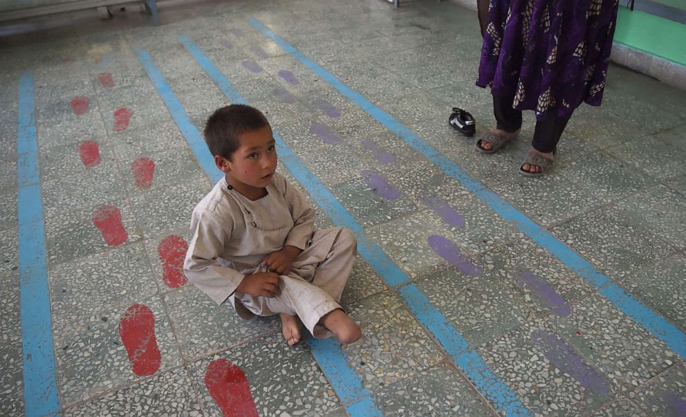 PHOTO: Ahmad Rahman, an Afghan boy who lost his right leg when he got caught in the crossfire of a battle, sits on the floor at the International Committee of the Red Cross clinic in Kabul on May 7, 2019.