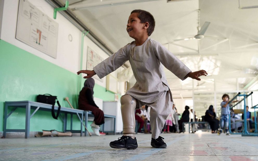 PHOTO: Ahmad Rahman, an Afghan boy who lost his right leg when he got caught in the crossfire dances with his prosthetic leg at the International Committee of the Red Cross clinic in Kabul on May 7, 2019.