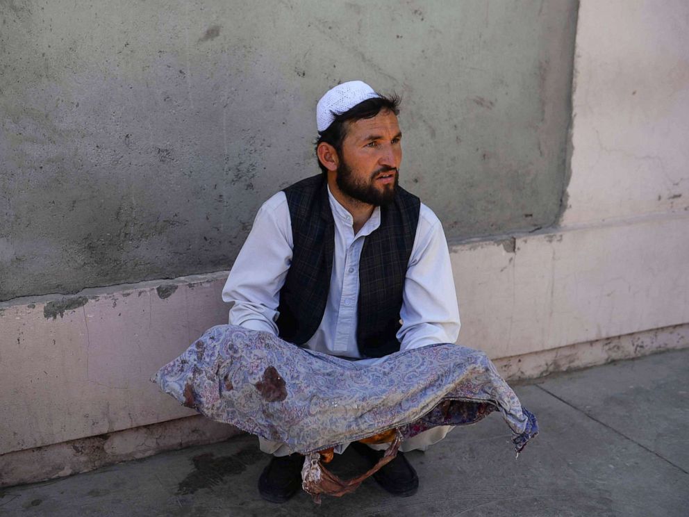PHOTO: An Afghan man holds the body of a child killed when a bus hit a roadside bomb on the Kandahar-Herat highway, at a hospital in Herat on July 31, 2019.