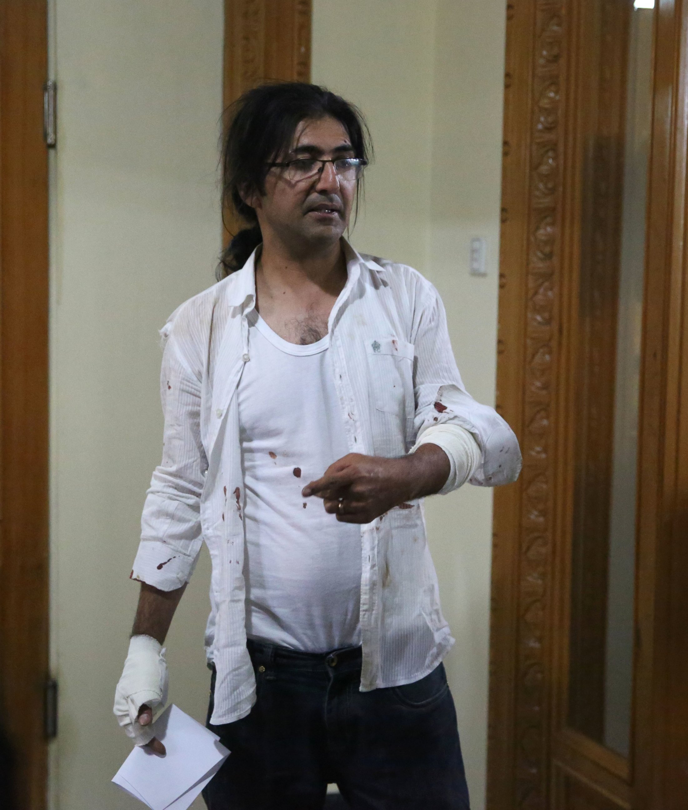 PHOTO: AP Photographer Massoud Hossaini arrives back in the AP main office in Kabul, after the attack on the campus of the American University in the Afghan capital Kabul on Aug. 24, 2016.