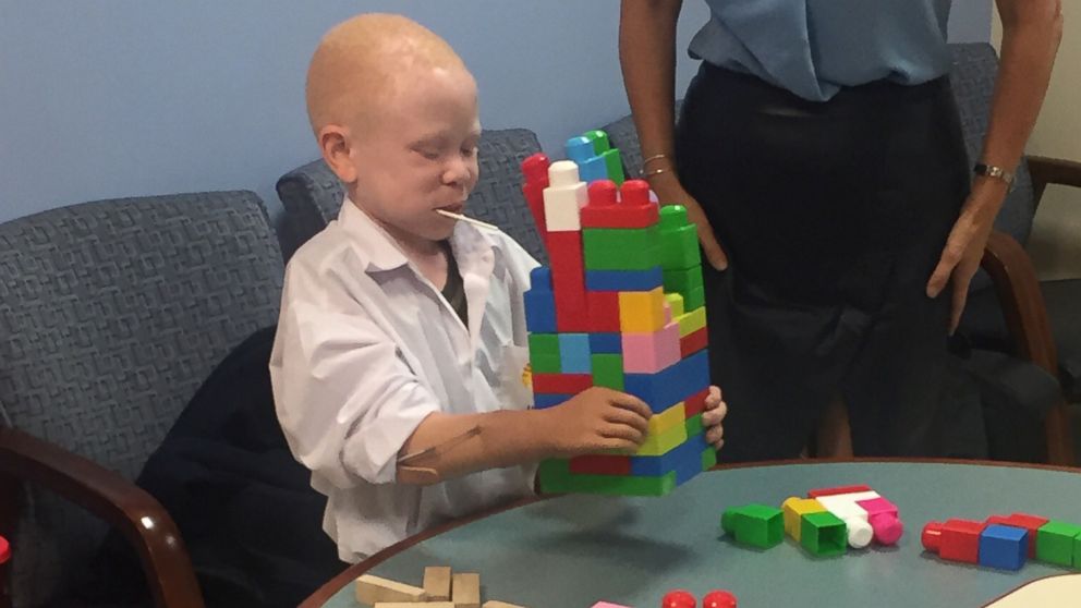 PHOTO: Baraka, a child from Tanzania whose arm was cut off because he has albinism, plays using his new prosthetic arm at Shriners Hospital for Children.