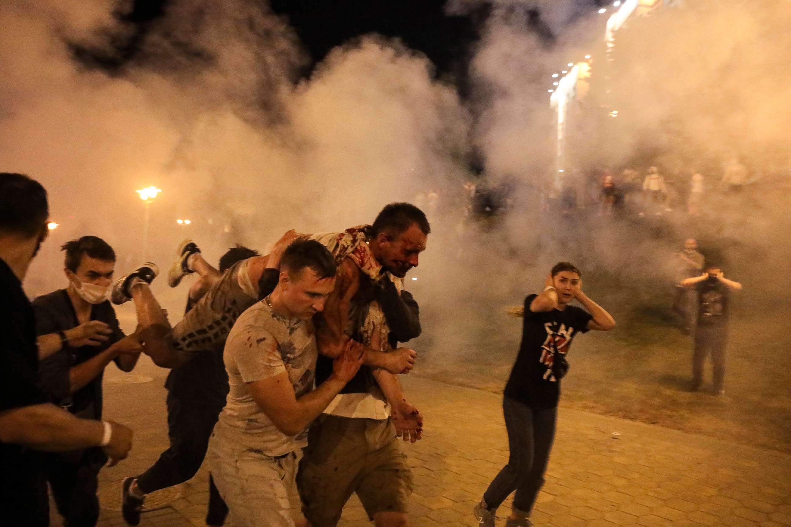 PHOTO: Protesters carry a wounded man during clashes with police after the presidential election in Minsk, Belarus, in the early hours of Aug. 10, 2020.