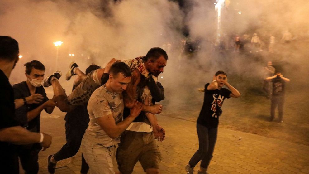 PHOTO: Protesters carry a wounded man during clashes with police after the presidential election in Minsk, Belarus, in the early hours of Aug. 10, 2020.