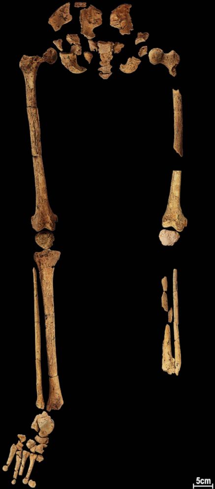 PHOTO: The 31,000 year-old-skeleton discovered in a cave in East Kalimantan, Borneo Indonesia, is photographed at Griffith University in Brisbane, Australia, Sept. 1, 2022. 