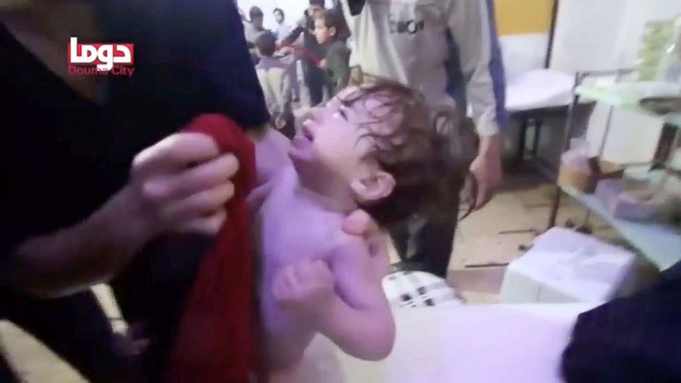 PHOTO: A child cries as they have their face wiped following alleged chemical weapons attack, in what is said to be Douma, Syria in this still image from video obtained by Reuters, April 8, 2018.