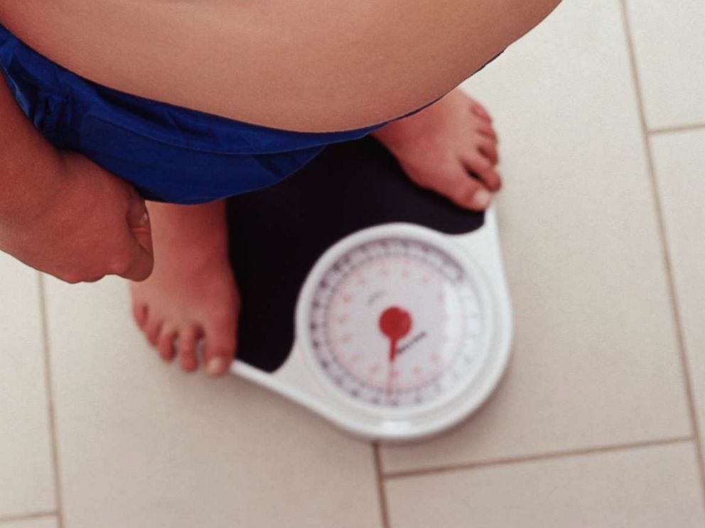 PHOTO: A boy weighing himself on a scale, who is overweight (obese), in this undated photo.  