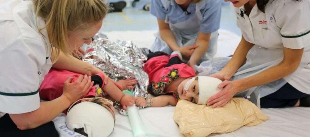 PHOTO: Great Ormond Street Hospital is internationally renowned for being one of the few hospitals in the world to have the infrastructure, facilities and team of experts to take on one the biggest challenges in medicine, separating conjoined twins.
