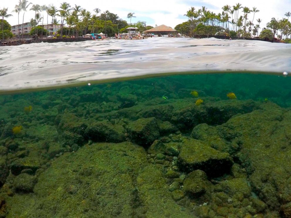 diet weight loss fat loss diet solutions PHOTO: In this Sept. 12, 2019, photo, fish swim near bleaching coral in Kahalau Bay in Kailua-Kona, Hawaii.