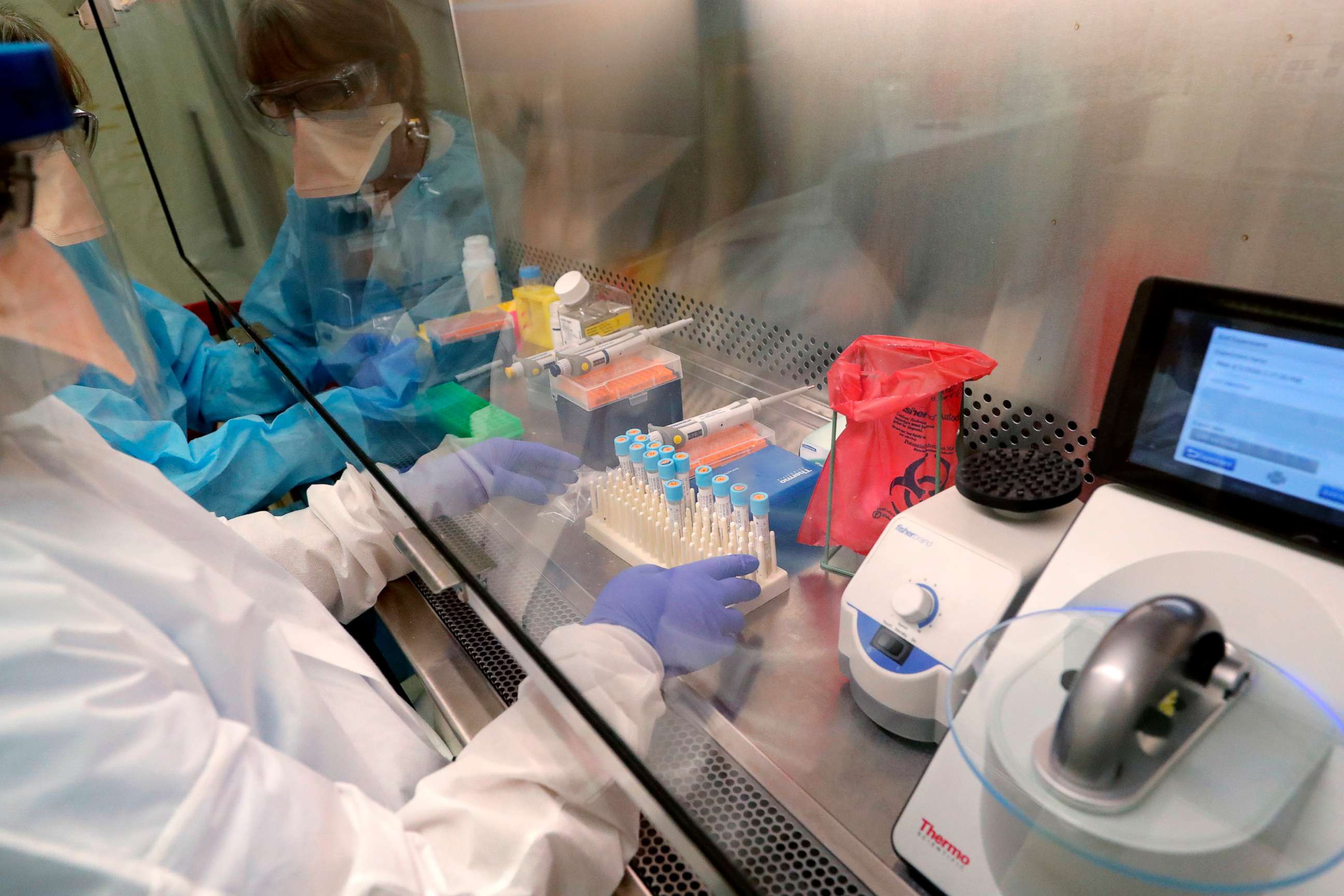 PHOTO: Cindy Morris, left, and Swarnamala Ratnayaka prepare RNA for testing for the new coronavirus at the molecular pathology lab at Tulane University School of Medicine in New Orleans, April 2, 2020. 