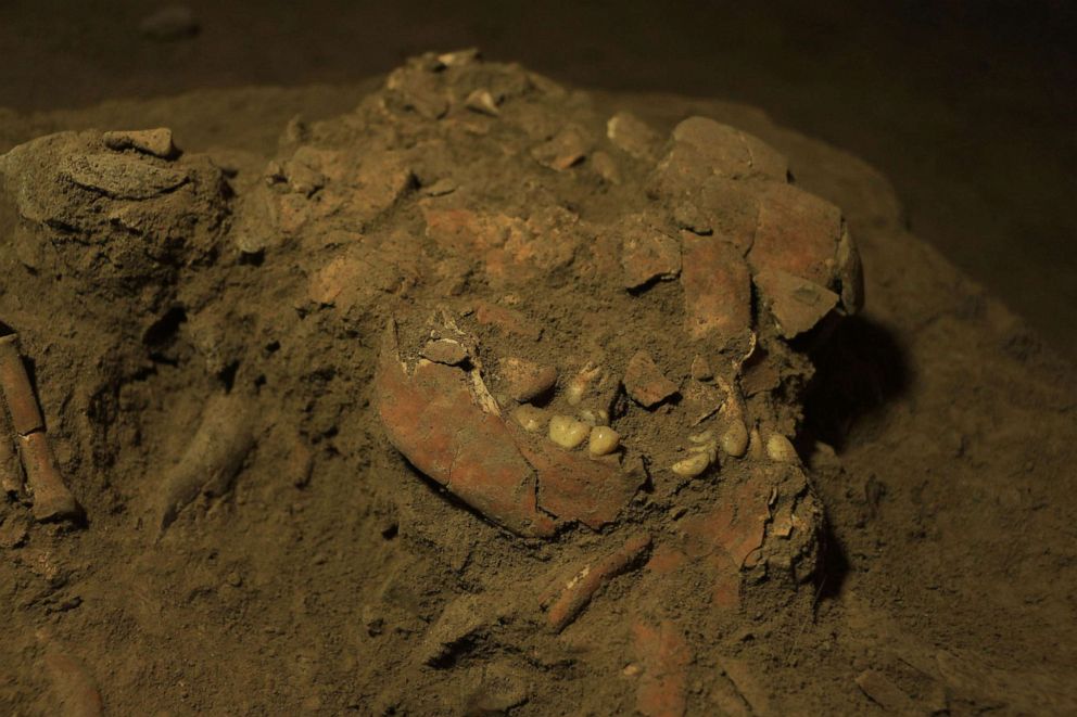 PHOTO: Fragmentary remains of the human skull.