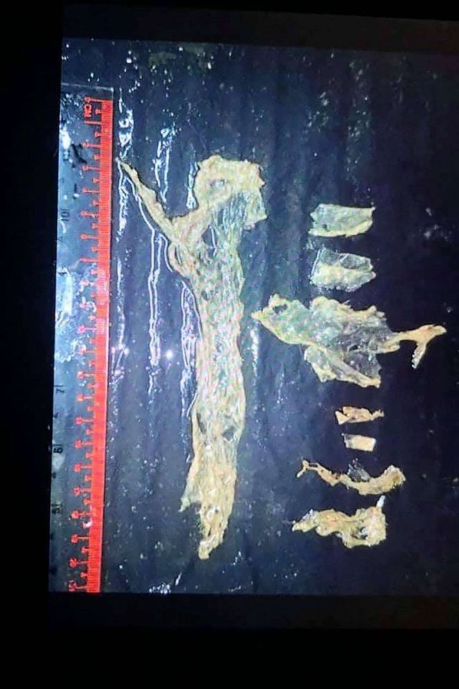 PHOTO: Pieces of plastic that were found in the intestinal tract of Mariam the dugong after she died at the Trang province marine park in a photo taken, Aug. 17, 2019. 