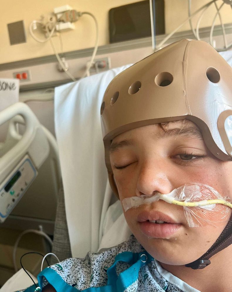 Little League player with head injury was 'near death' but makes  'tremendous progress' 