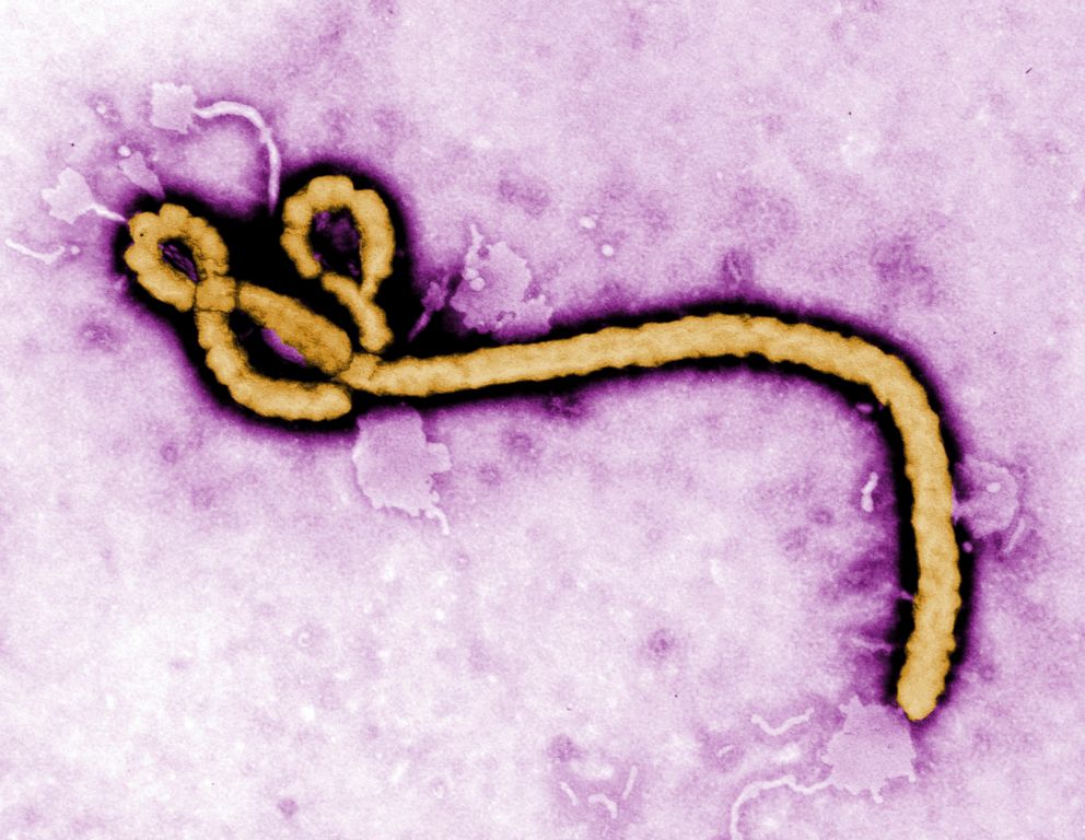 PHOTO: An Ebola virus virion is pictured in this undated colorized transmission electron micrograph file image made available by the CDC.