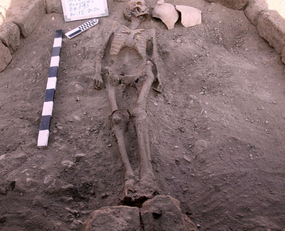 PHOTO: Skeletal human remains sit in the archeological dig site in Luxor, Egypt, in this undated handout photo.