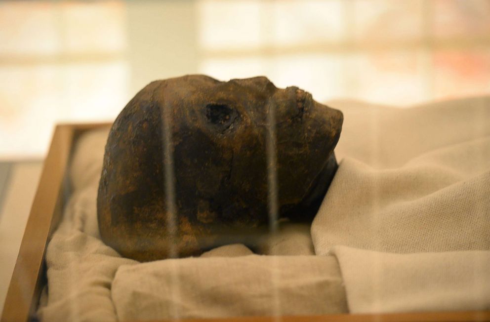 PHOTO: The head linen-wrapped mummy of of the 18th dynasty Pharaoh Tutankhamun displayed in his climate-controlled glass case in his underground tomb in the Valley of the Kings on the west bank of the Nile river south of the capital Cairo.