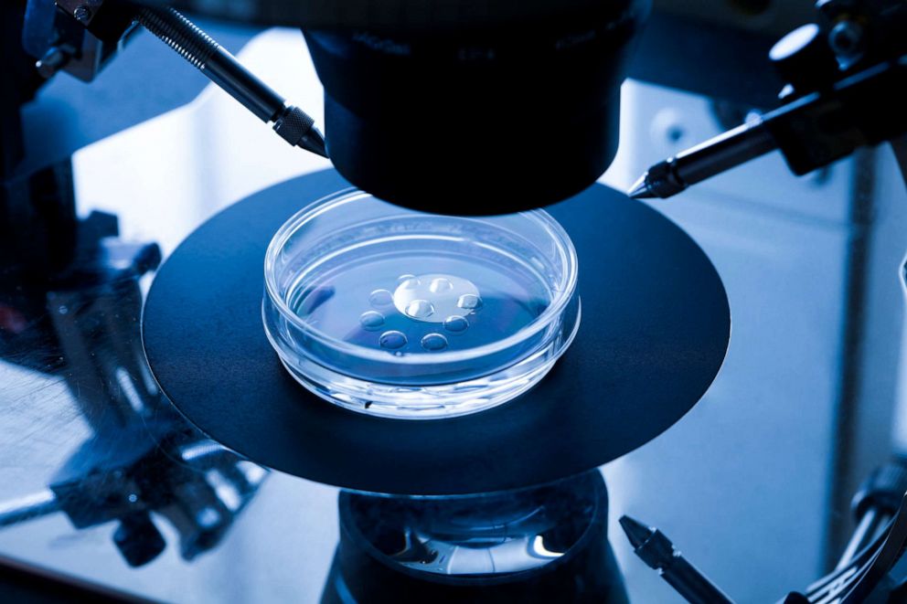 PHOTO: Embryo culture dish used for in vitro fertilization (IVF) is pictured in this undated stock photo.